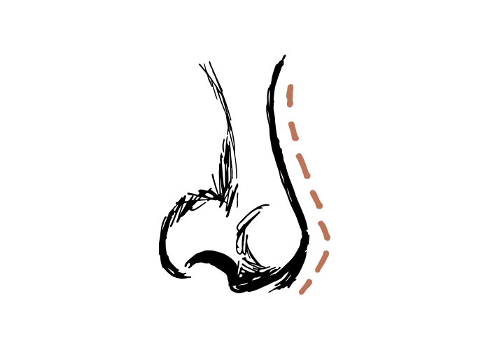 Neuscorrectie