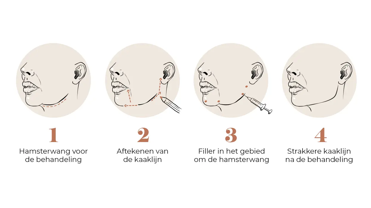 Zo kun je je dubbele kin verwijderen zónder operatie