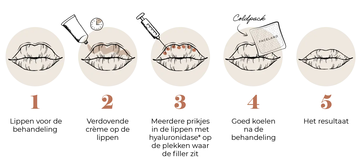 Lip fillers mislukt? Déze oplossing helpt echt